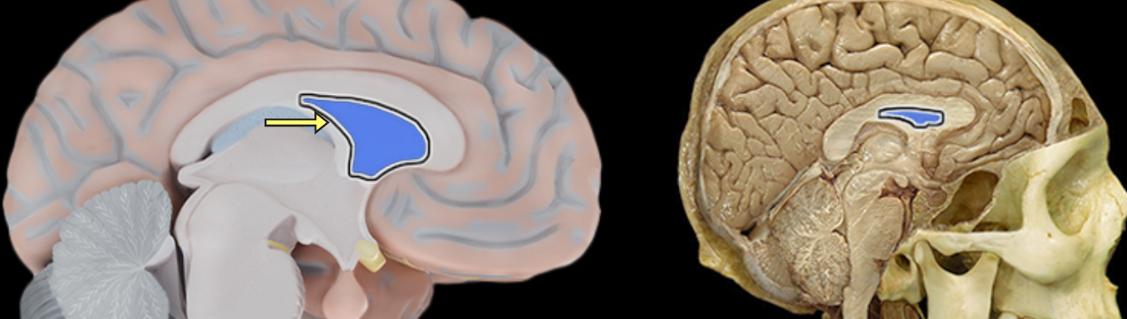 <p>Septum pellucidum</p>