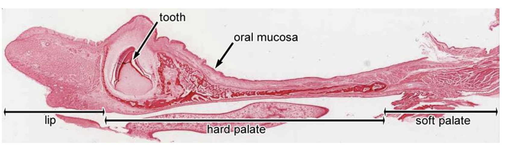 Hard and Soft Palate 

Hard Palate separates into? 