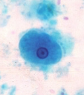 term image