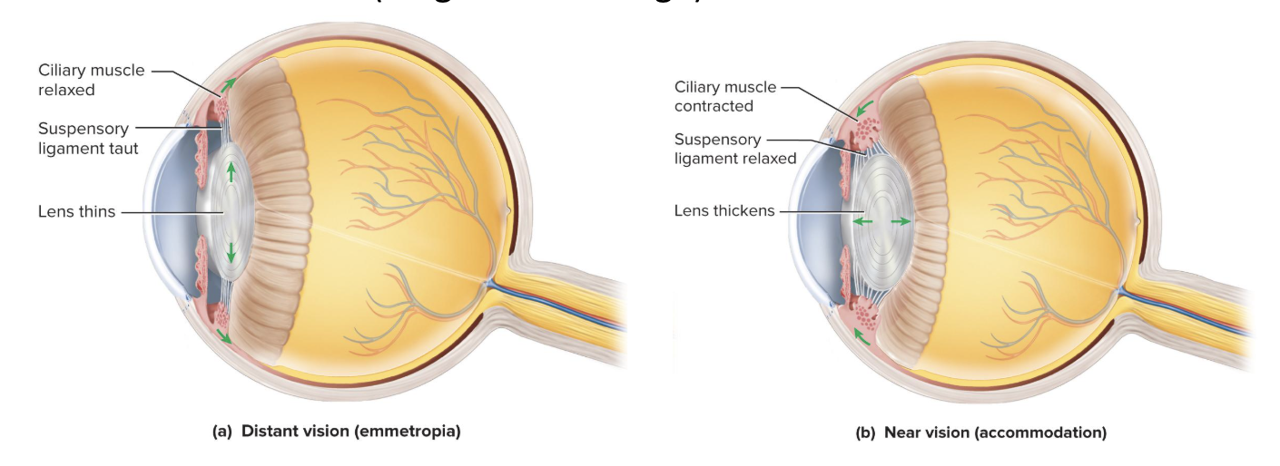 <p>Ciliary muscle contracts, suspensory ligaments slacken, and lens takes a thicker shape</p><ul><li><p>causes light to be refracted more strongly and focused onto the retina</p></li></ul><p></p>