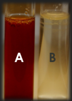 <p>Nitrate Broth: A &amp; B added — What are the TWO possible results for organism B?</p>