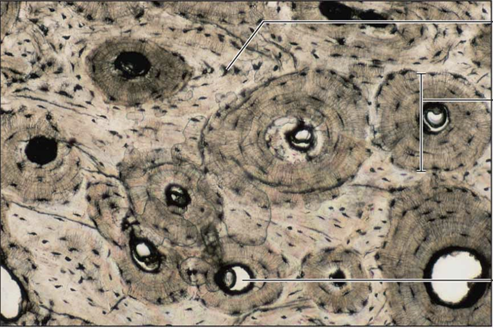 <p>ground bone connective tissue</p>
