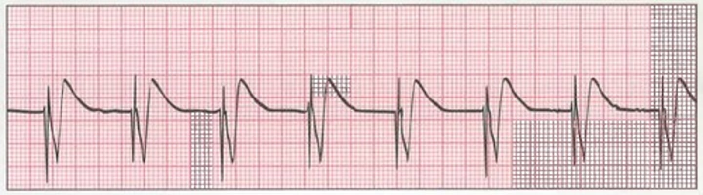<p>what is this ekg</p>