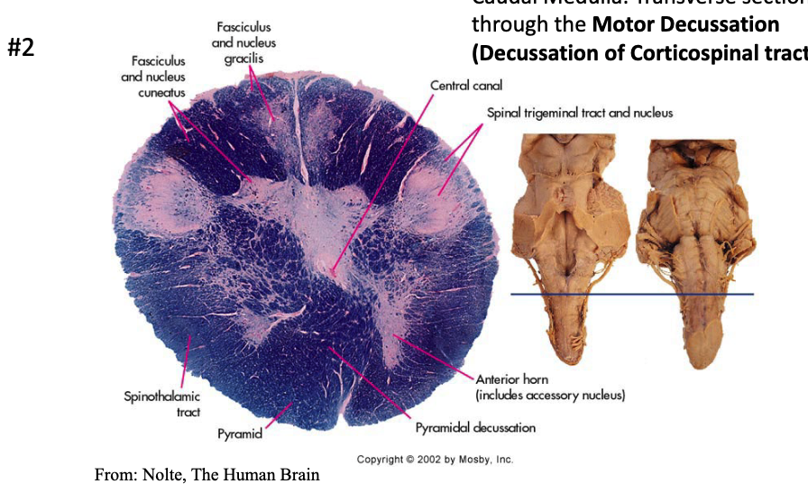 <p><strong>at the caudal medulla</strong>, specifically at the <strong>pyramidal decussation</strong></p>