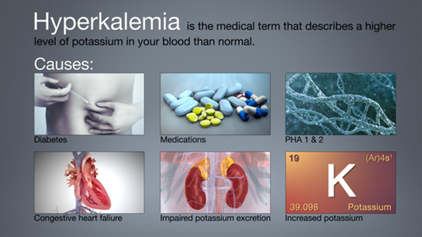 <p>- potassium levels are too high (K+ &gt;5 mEq/L)</p><p>- most common cause: drugs (eg. potassium sparing diuretics), renal disease</p><p>- tx: Kayexalate (PO enteric, NG)</p><p>- fx: binds K+ in intestines &amp; excrete via stool</p>