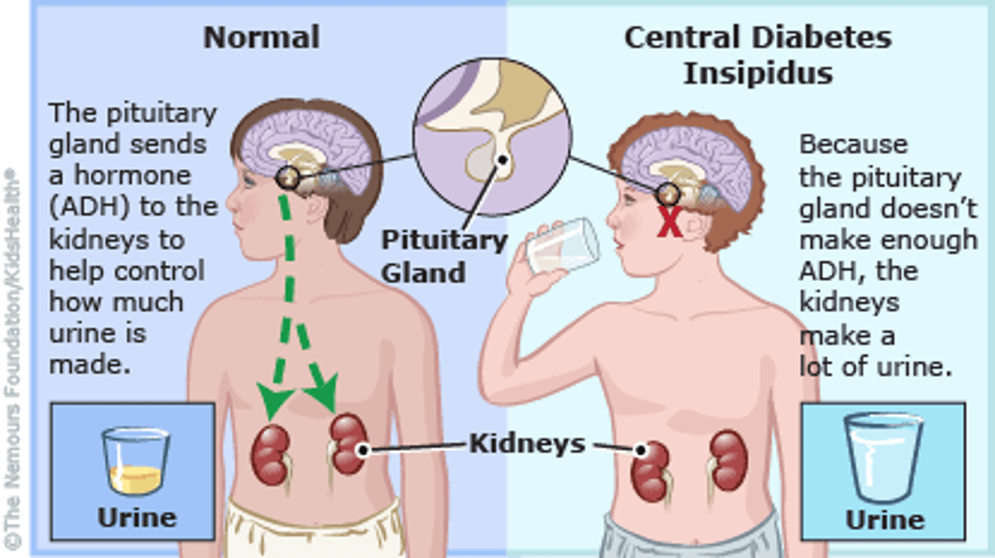 <p>Promotes water conservation (reabsorption) by kidneys, TT is kidneys</p><p>- Diabetes Insipidus = too little ADH, large volumes of diluted urine, dehydration, thirst, and fatigue</p>
