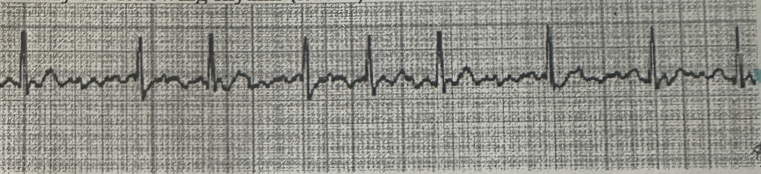 <p>The p waves in this strip….</p>