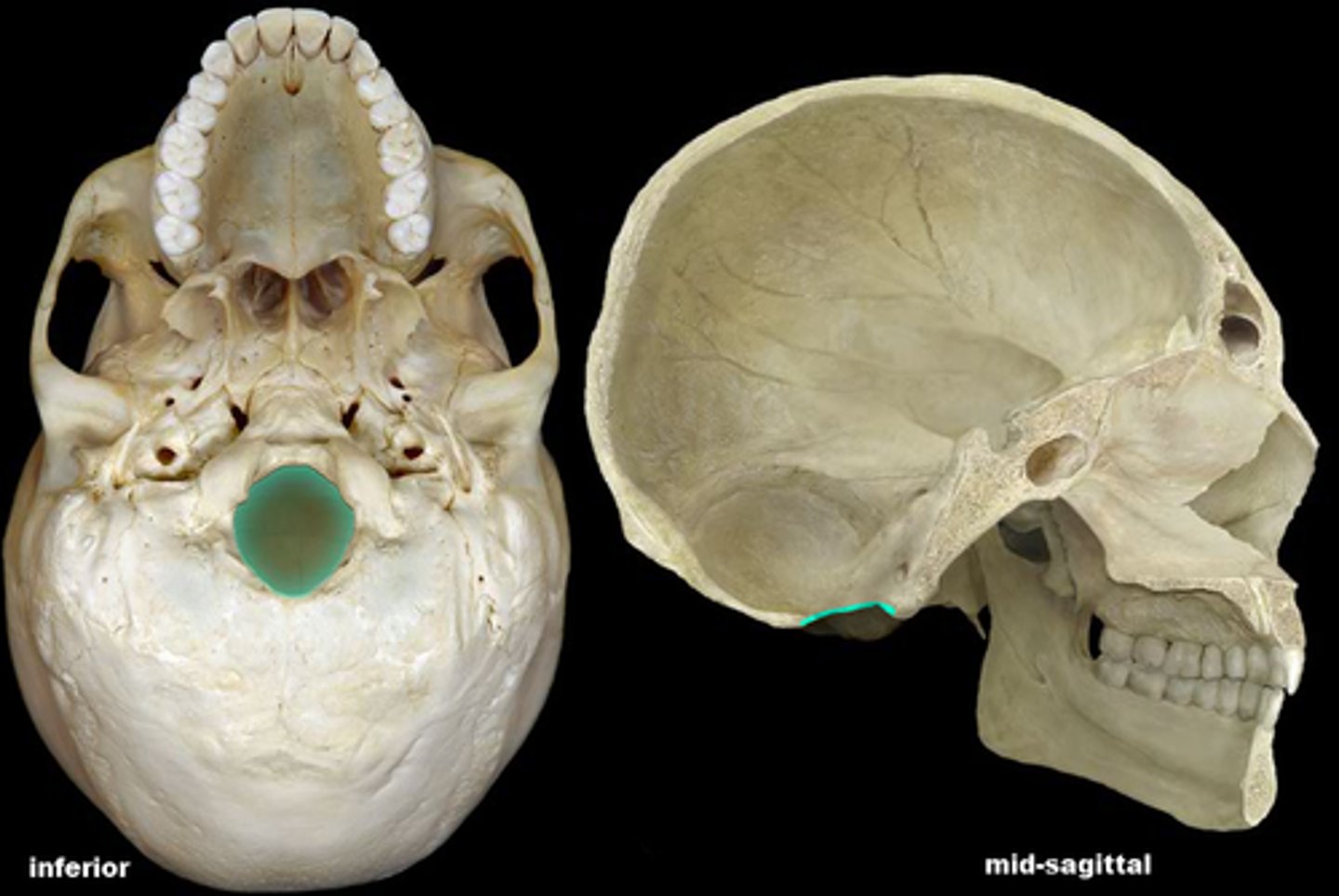 <p>biggest hole in the skull</p>
