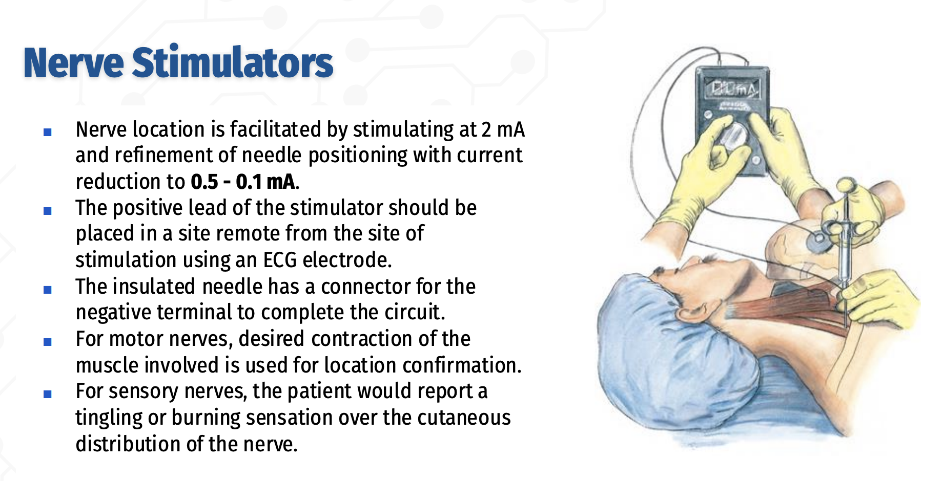 <p>Peripheral Nerve Stimulator – Technique &amp; Confirmation</p>
