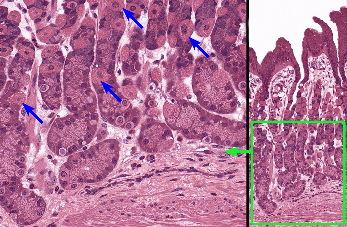 <p>secretes hydrochloric acid (break down food and activates pepsinogen to pepsin), dark purple nucleus and a pink cytoplasm</p>