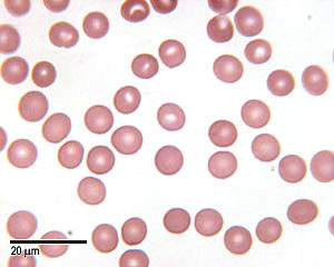 <p>in <strong>erythrocytes</strong> numbers generally range from?</p>