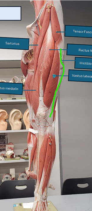 <p>- WHITE BAND</p><p>function not required! </p><p></p>