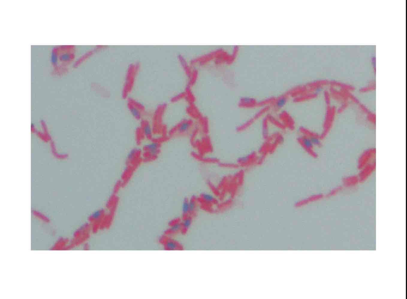 <p>Cell division and differentiation into endospores.</p>