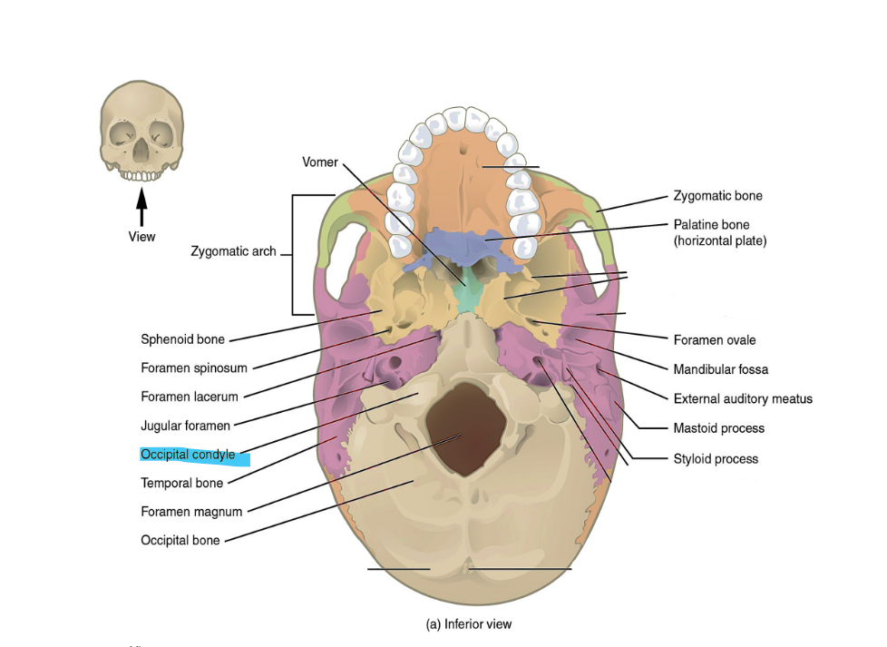 <p>occipital condyle</p>