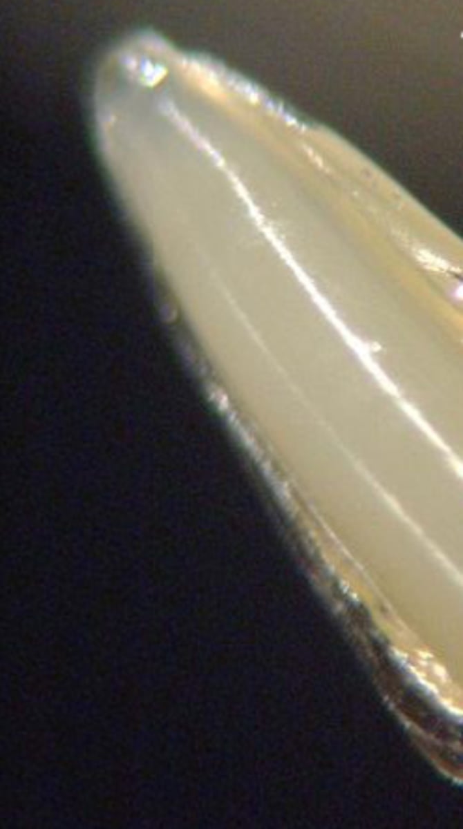 <p>What roundworm is this in scientific name?</p>