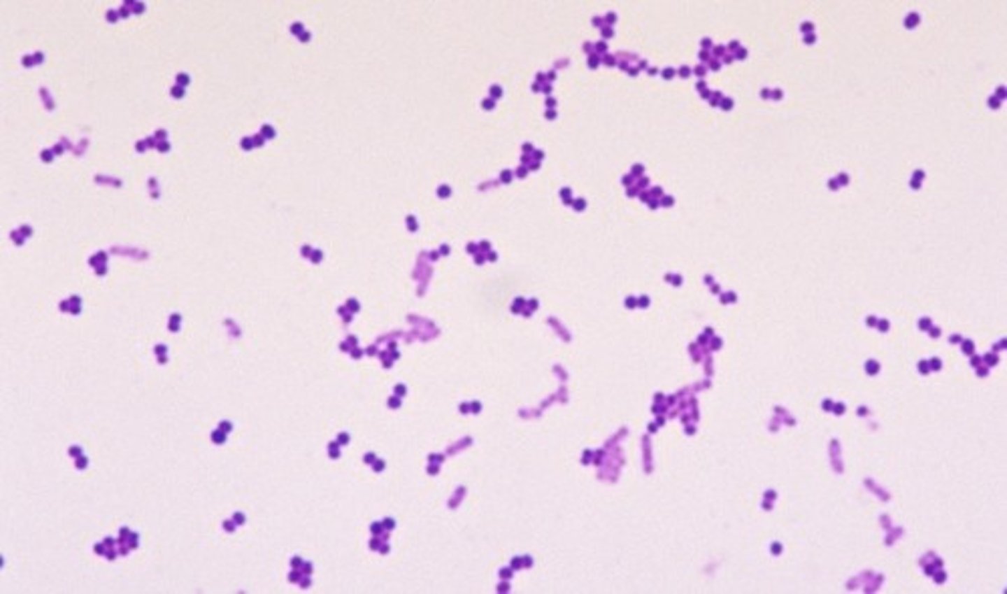 <p>Purple</p>