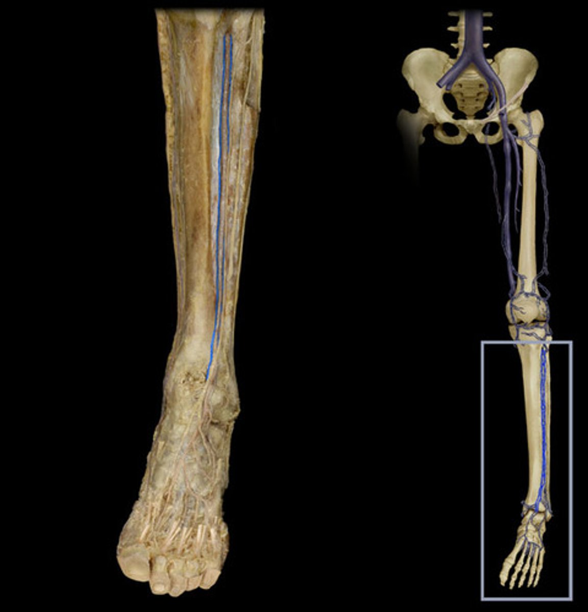 <p>Identify the vessel (include artery vs vein)</p>