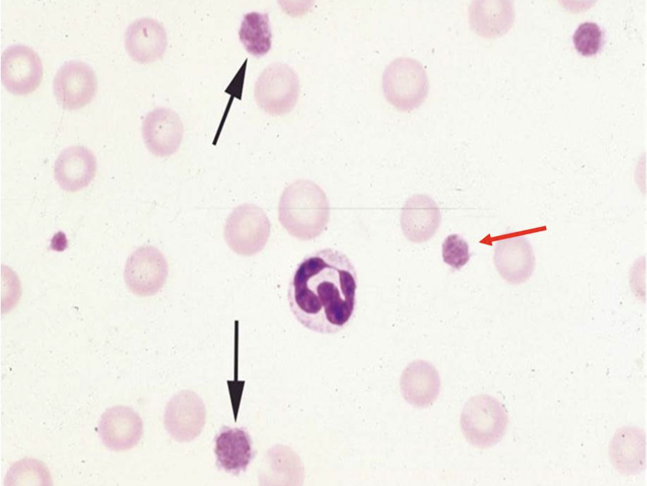 <p>The red arrow refers to a structure that is</p>
