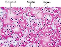 <p>How do you apply a capsule stain using Congo Red and Manevals Stain?</p>