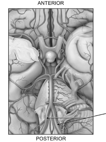 <p>Which vessel is labeled in this diagram of the circle of willis? </p>
