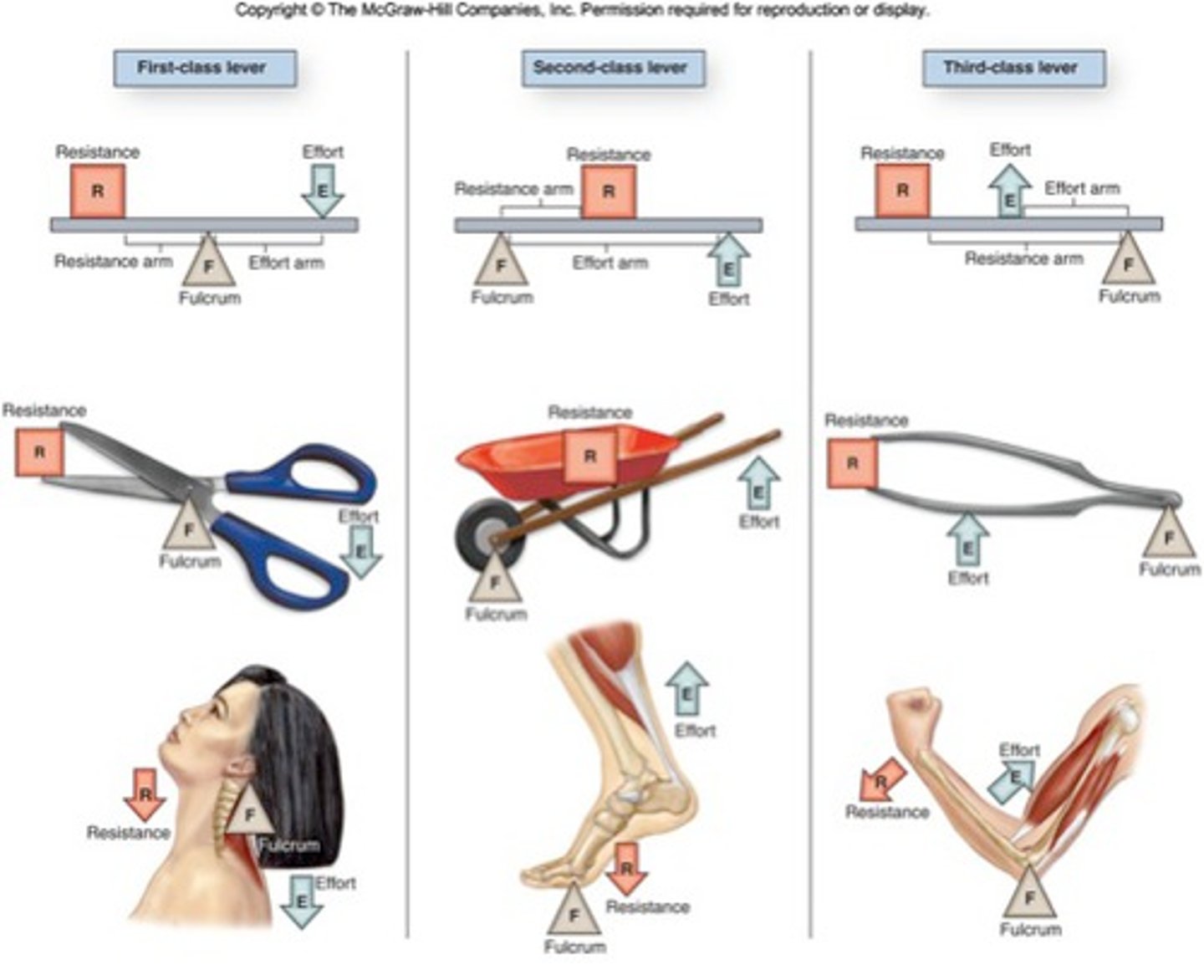 <p>b. Second<br><br>(muscle acts as a form of resistance as gravity/weight of dumbbell pulls arm down)</p>