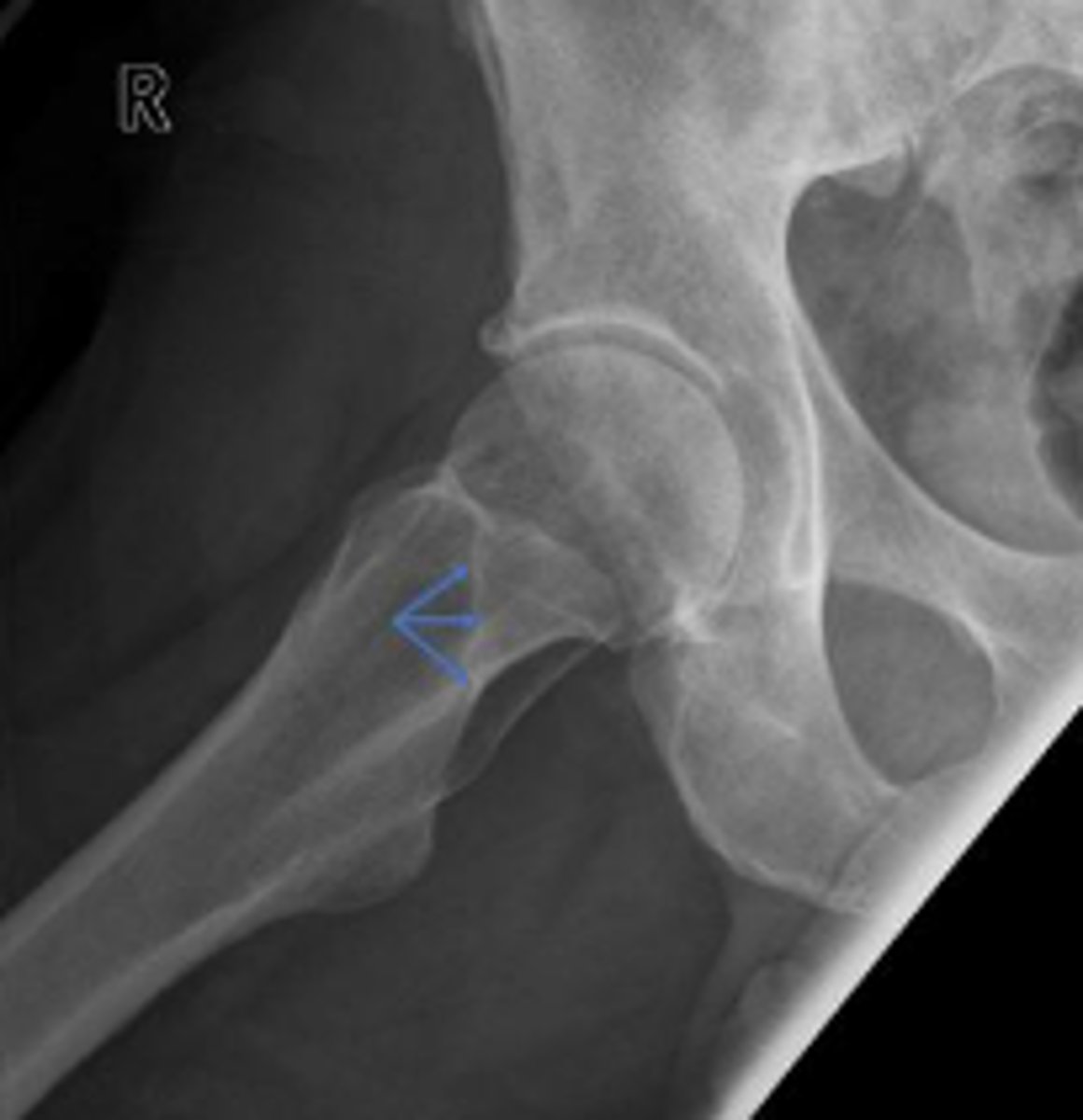 <p>What are the arrows pointing to?</p>