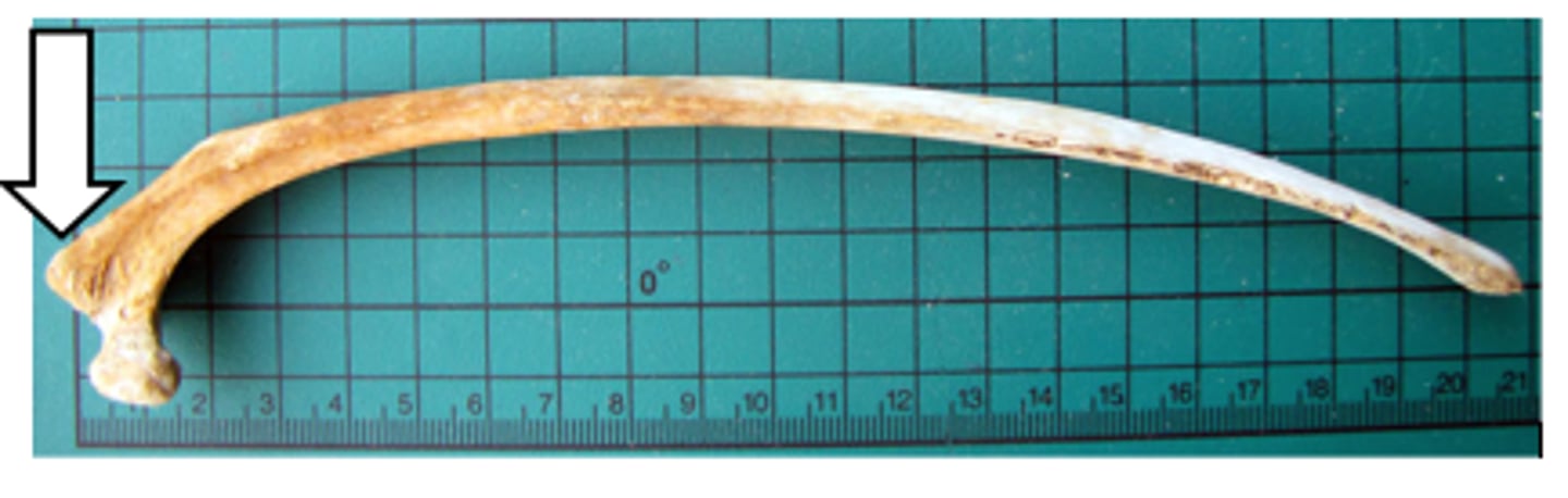 <p>Rib - transverse facet articulation</p>