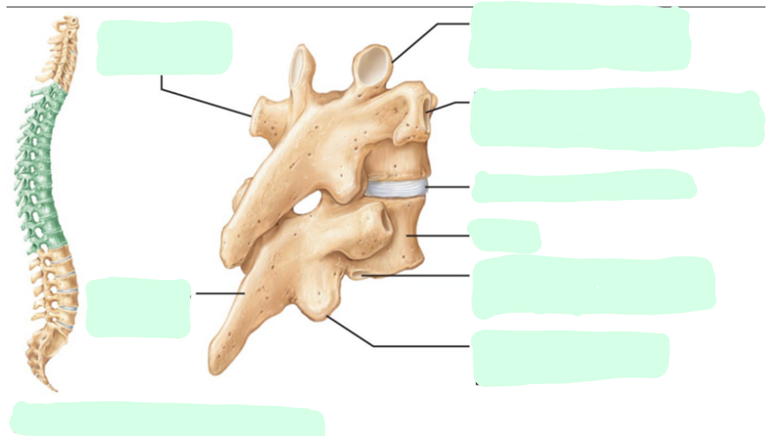 <p>Where is the <strong>Centrum/Body</strong> of the thoracic vertebrae?</p>