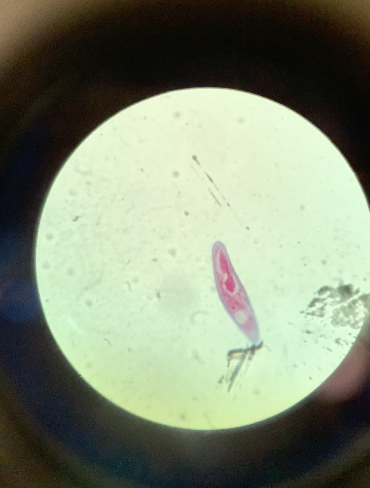 <p>protist?</p>