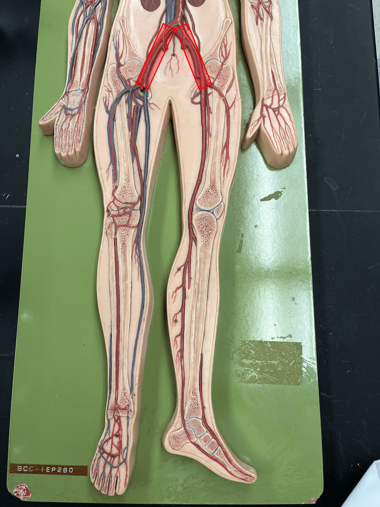 <p>• An artery of the lower limb.</p>
<p>• Originates from the common iliac artery.</p>
<p>• Supplies the lower limb through its branches.</p>