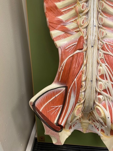 <p>Iliopsoas</p>