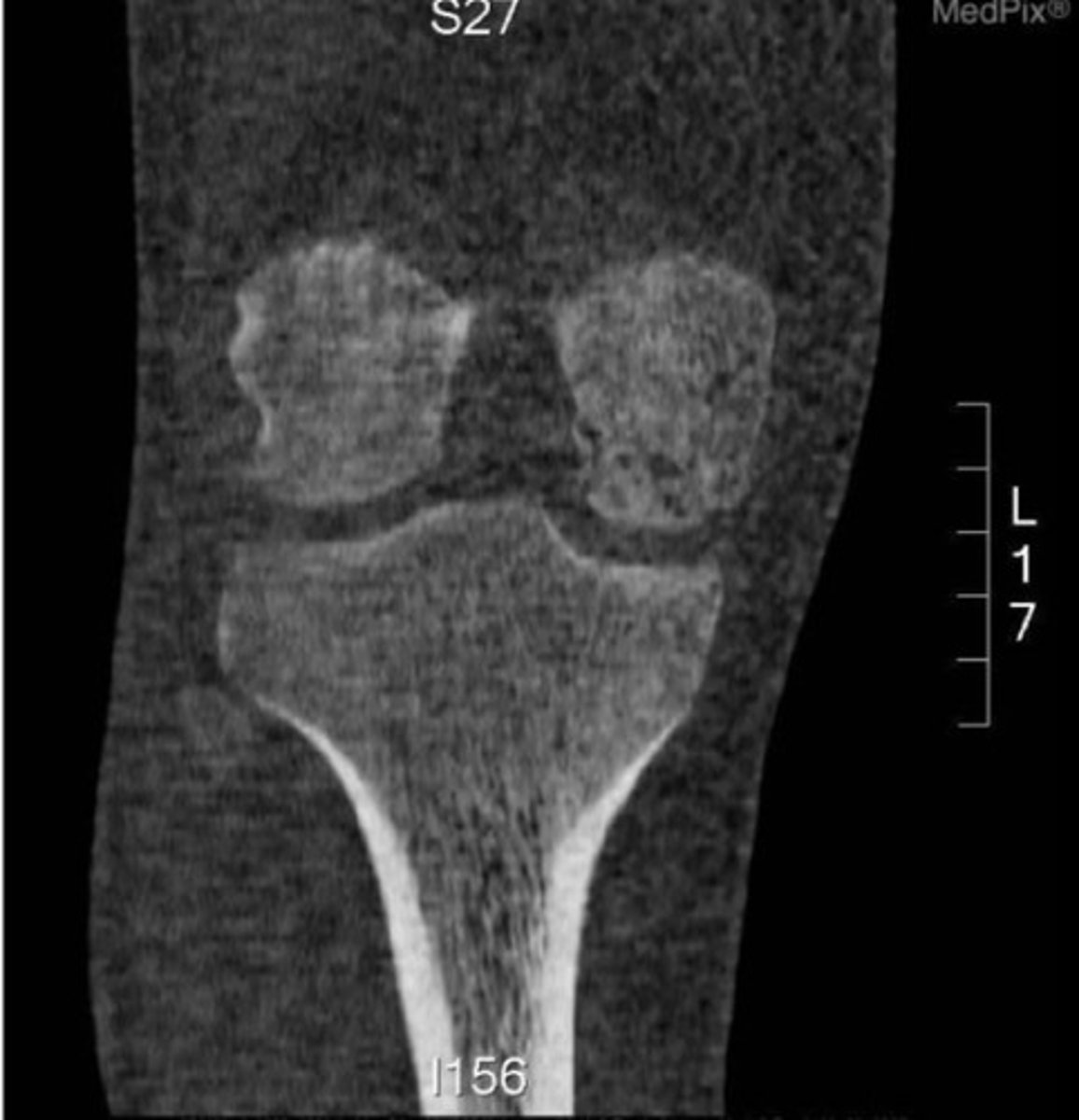<p>What view of a CT is this?</p>