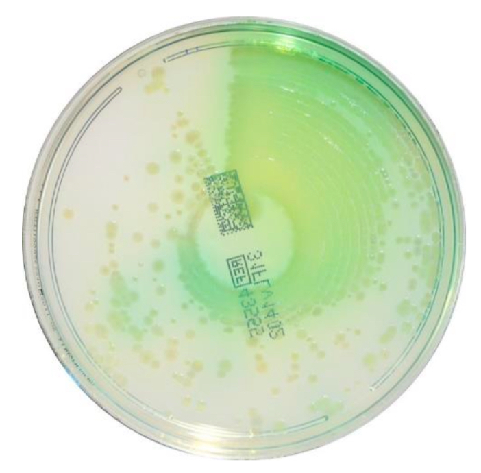 <p>what is the selective agent in cetrimide?</p>