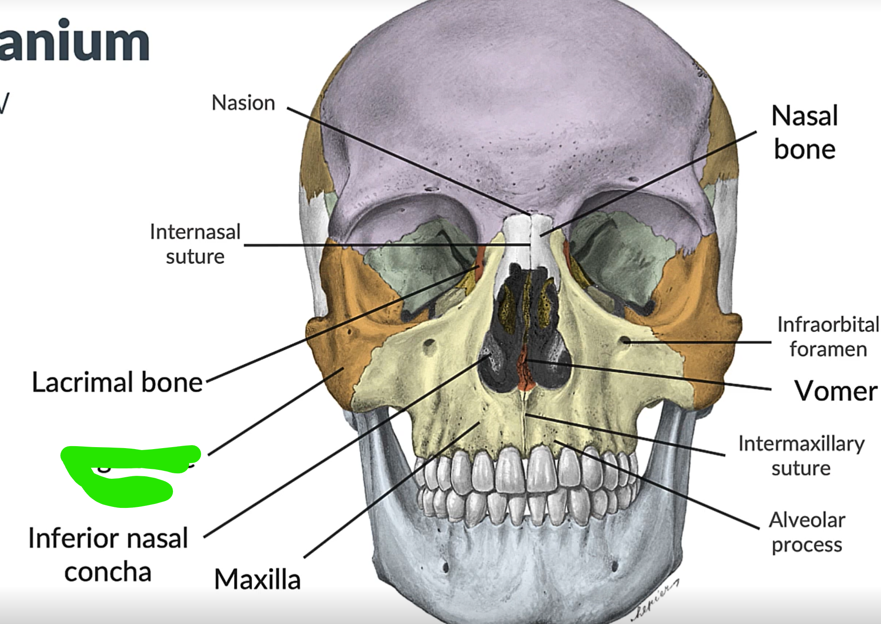term image