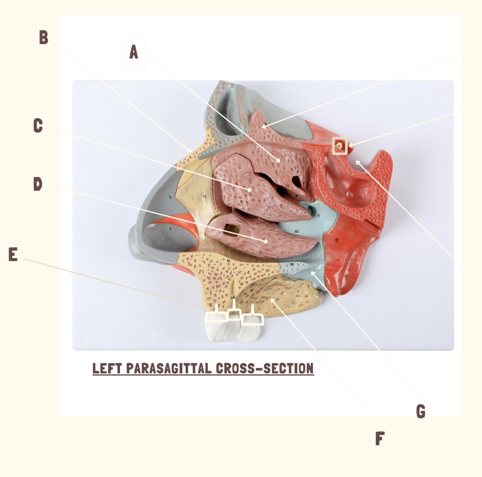 <p>Use this parasagittal cross-section to identify ethmoid/sphenoid bone features</p>