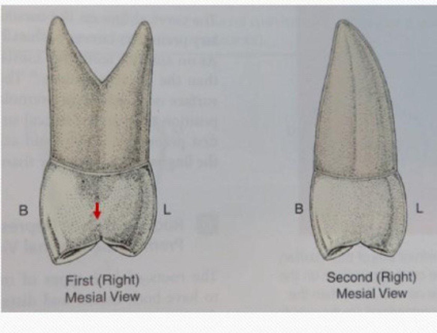 <p>Mesial and distal groove on __ is much less frequently</p>