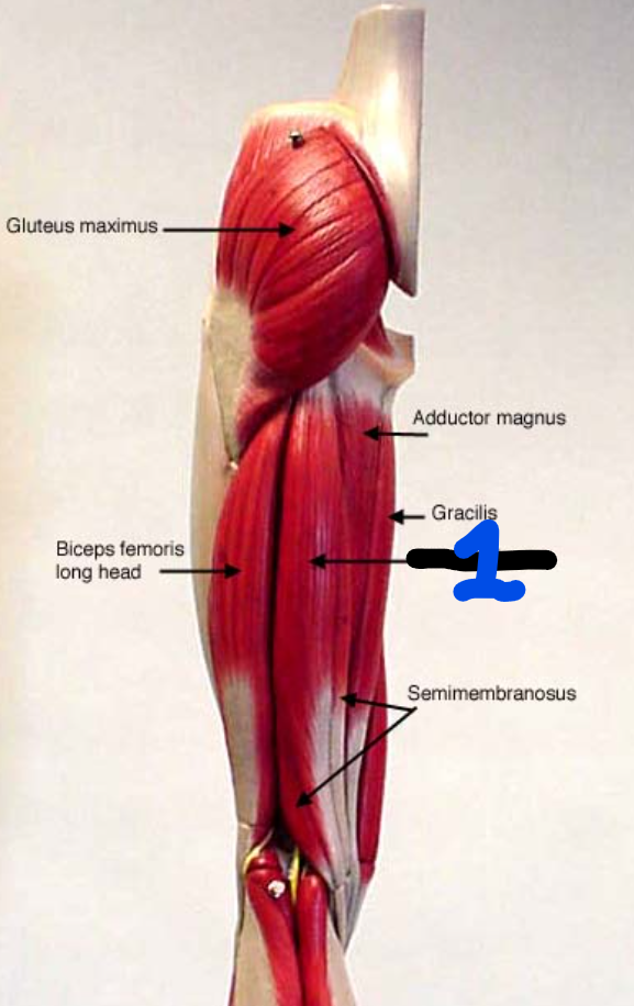 <p><span style="font-family: Arial, sans-serif">Name the muscle found at 1:</span></p>