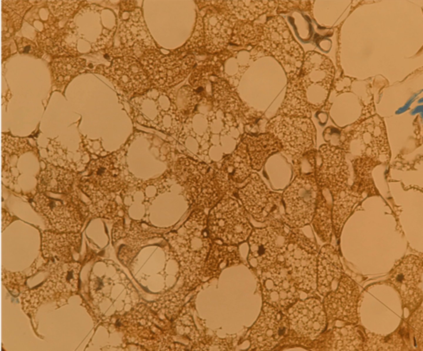 <p>- Specialiserad bindväv</p><p>- innehåller massa mitkondrier med järn, därav brun</p><p>- <strong>multivakuolär cell (flera droppar)</strong></p>