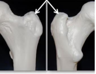 <p>Large, rough projection</p><ul><li><p>Proximal femur only</p></li><li><p>Muscle attatchment</p></li></ul><p></p>