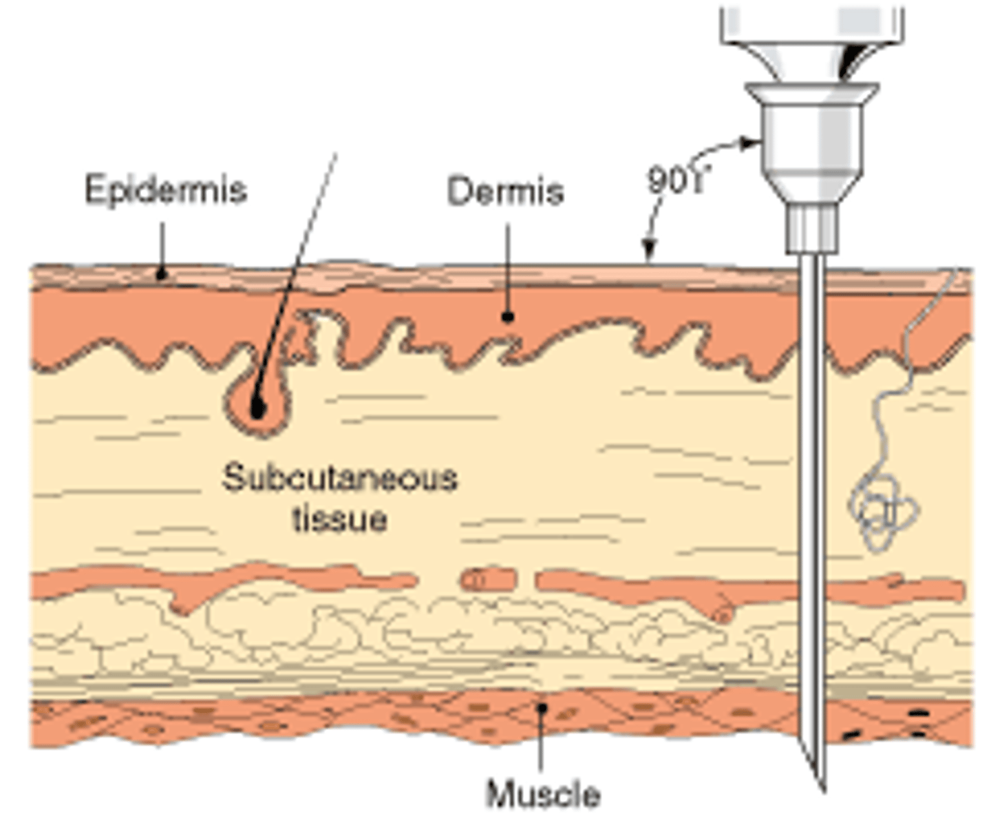<p>(In-truh-MUS-kyoo-ler) within the muscle. (ដែលជ្រាបចូល រឺ ចាក់ចូលក្នុងសាច់ដុំ)</p>