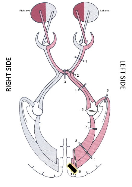 <p>what is it? what does it result in? </p>