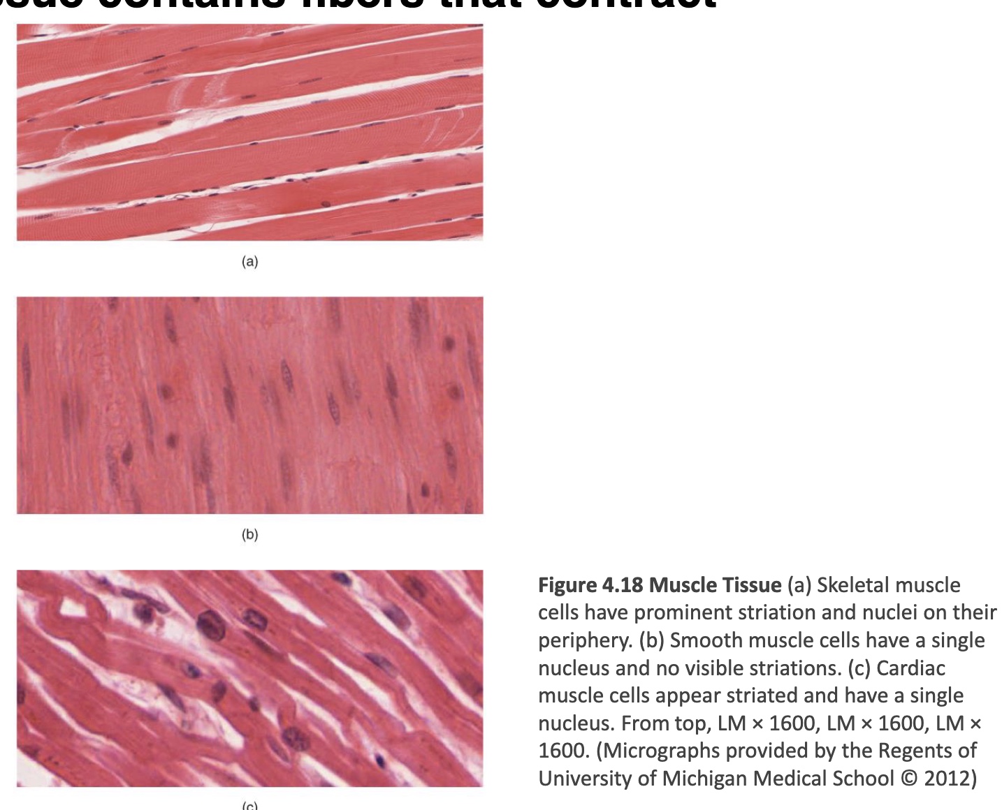 <p><strong>-contains fibers that contract</strong></p><p><strong>-3 main types: cardiac, smooth, and skeletal muscle</strong></p><ul><li><p>Cardiac: just in the heart, “hybrid” of smooth and skeletal</p></li><li><p>Smooth</p></li><li><p>Skeletal: long, parallel fibers</p></li></ul><p></p>