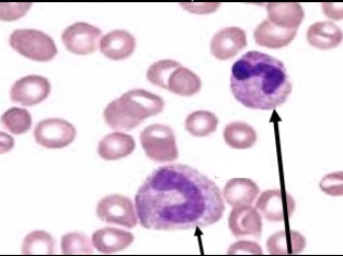 <p>Immature form, nucleus has no lobes or segments </p>