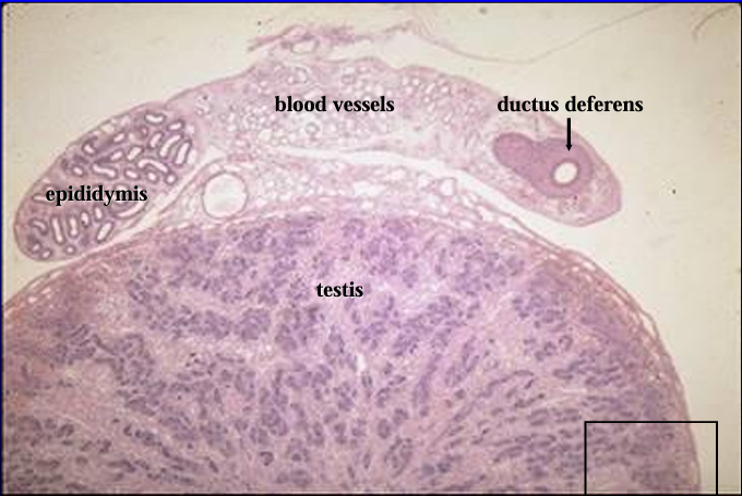 <p>Section of the <strong>testis</strong> (bottom), <strong>epididymis</strong> (top left), and <strong>ductus deferens</strong> (top right) of a 1-day-old pig.</p><p></p>
