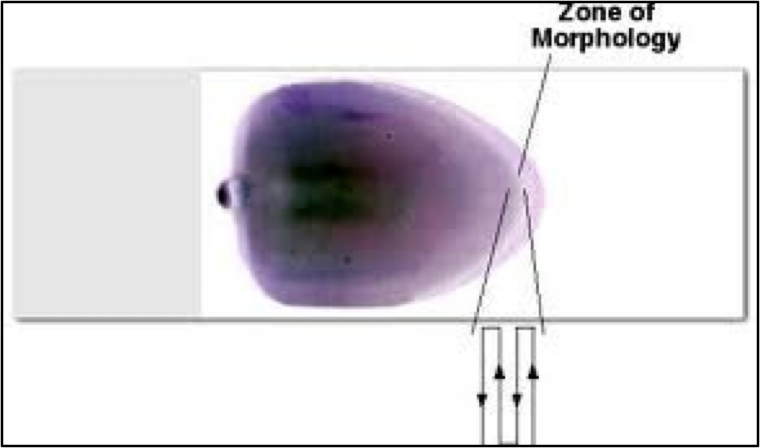 <p>name zones from left to right</p>
