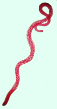 <p>Trichinella spiralis</p>