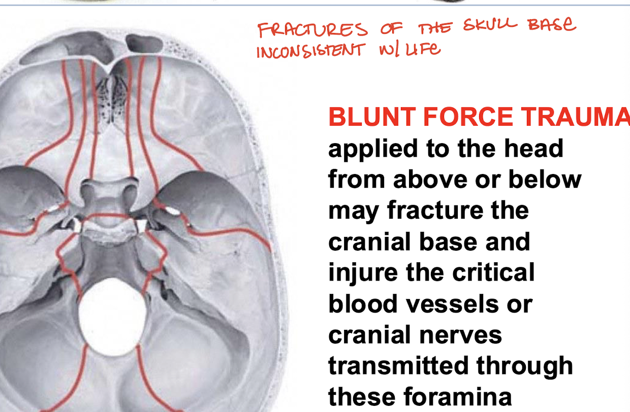 <p>The cranial base and injure the critical vessels or cranial nerves transmitted through the foramina</p>