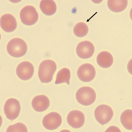 <p>What characteristic describes the size of this erythrocyte?</p>