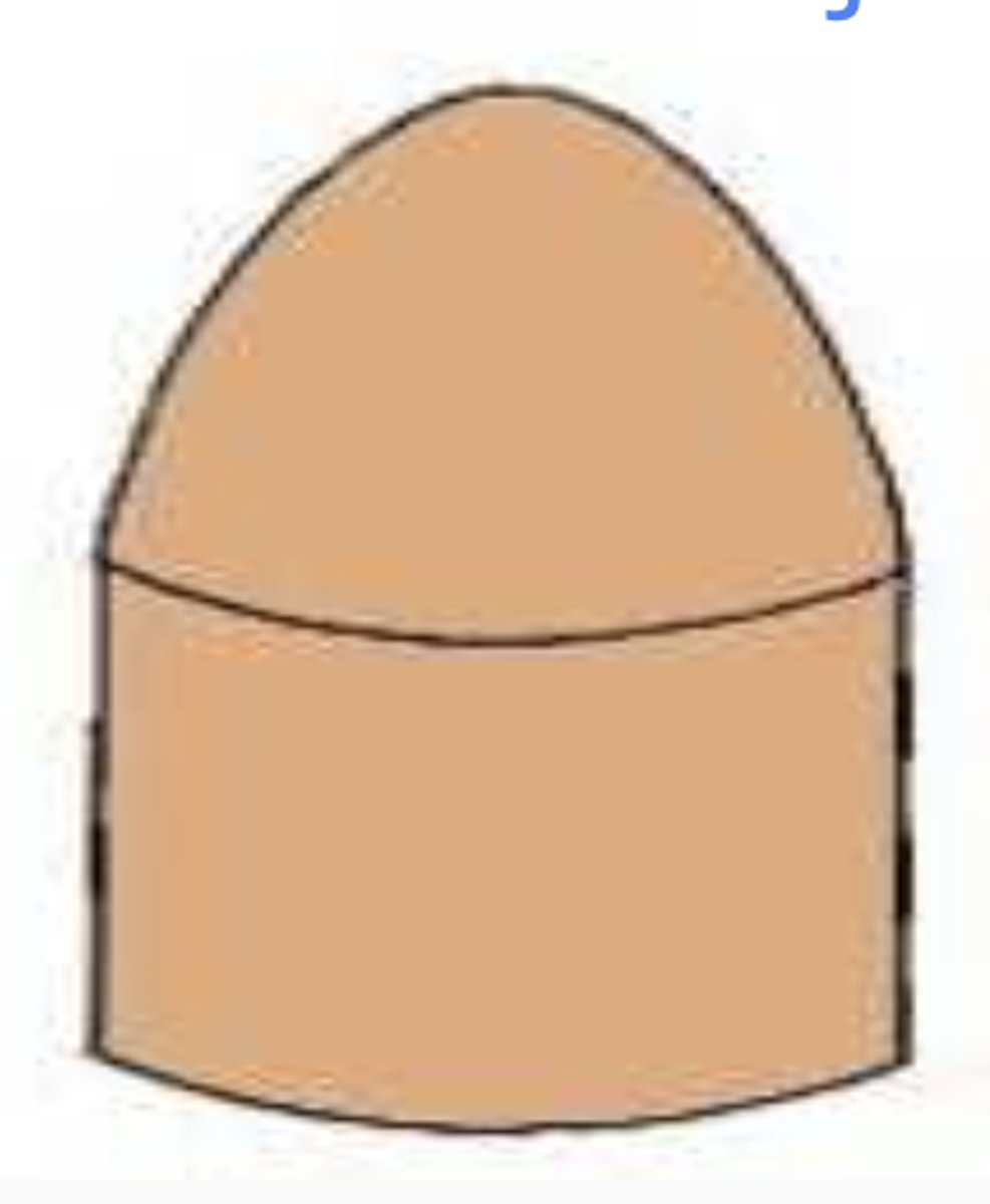 <p>-Fully encased</p><p>-Resilient, keeps its shape</p>