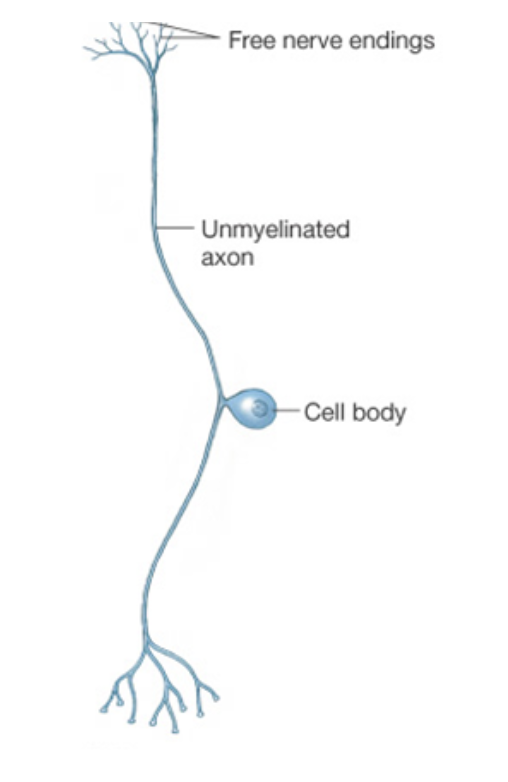 <p>What type of neuron is this?</p>